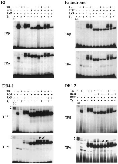 A Comparison Of Binding Of Tr Ror1 And Rxr On Various Tres In Vitro Download Scientific