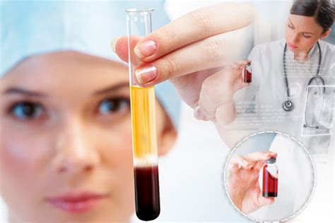 PRP Platelet Rich Plasma Nedir Tanfer Hastanesi