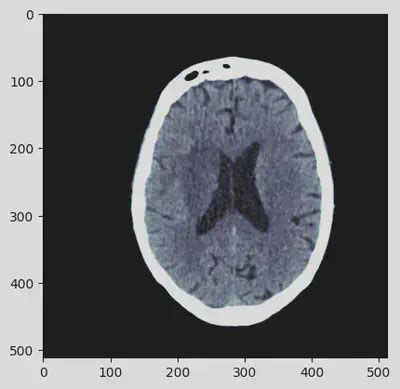 DICOM images in Python: An overview | Giovanni Pecoraro