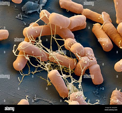 E Coli Bakterien Farbig Scanning Electron Micrograph Sem Escherichia Coli Sind Gram