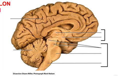 Major Regions of the Brain Diagram | Quizlet