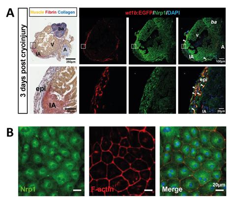 Figure S8 Epicardial Cells Express Nrp1 In Vivo And In Vitro A Download Scientific Diagram