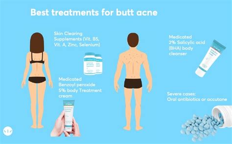 How To Get Rid Of Pimples On The Butt Mdacne