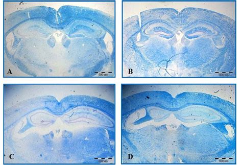 Luxol Fast Blue Staining Significant Differences Are Observed Among