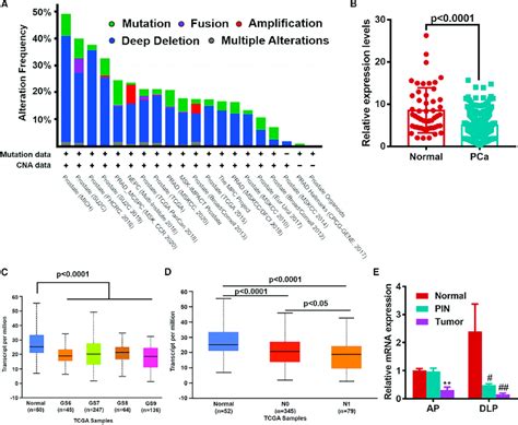 PTEN Expression Pattern In Human And Mouse PCa A The Panels Showing