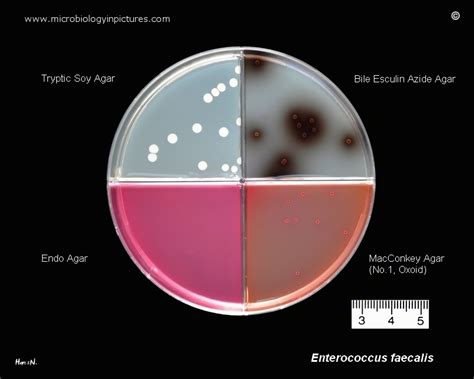 Enterococcus Faecalis Growth On Tryptic Trypticase Soy Agar TSA