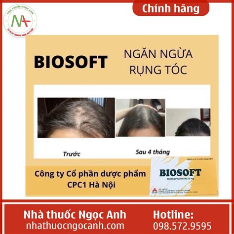 Biosoft có công dụng gì? Giá bao nhiêu? Mua ở đâu?