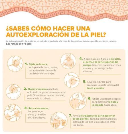 Día de la Prevención del Cáncer de Piel Conoces la regla ABCDE para