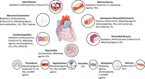 Cardiovascular Toxicities Of Cancer Therapies Cardiovascular