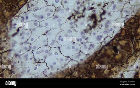 Simple Squamous Epithelium Mesothelium Epithelium That Lines The