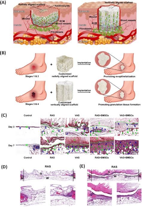 A In Vivo Application Of Two Perspective Aligned Scaffolds In Wound