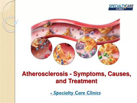 PPT Atherosclerosis Symptoms Causes And Treatment PowerPoint