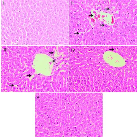 Photomicrograph Of Rat Liver Obtained From Different Treatment Groups