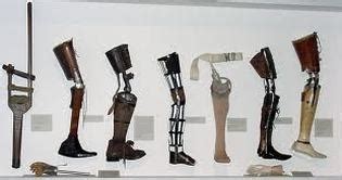 The History of the Prosthetic Limbs - Prosthetics: Here Today and ...