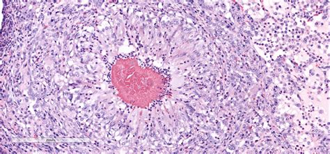 Dermatophilus Congolensis Associated Bronchopneumonia In An Alpaca