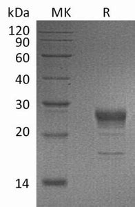 Human Kgf C His Protein Neweast Biosciences Gtpase Oncogene And