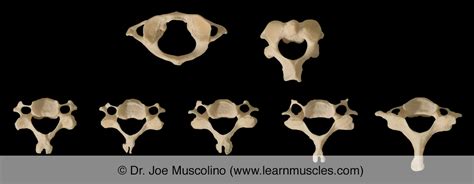 Cervical Vertebrae Learn Muscles