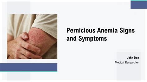 Signs Symptoms Anemia Powerpoint Presentation And Slides Ppt Template