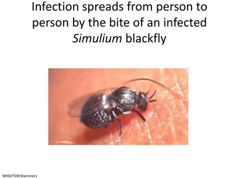 Ppt Onchocerciasis River Blindness” Powerpoint Presentation Free