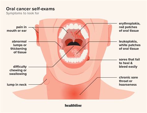 Oral Cancer Screening Importance Procedure Recommendations