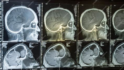 Premium Photo | Neurology Reveals Exploration of CT Scan Tomography and ...