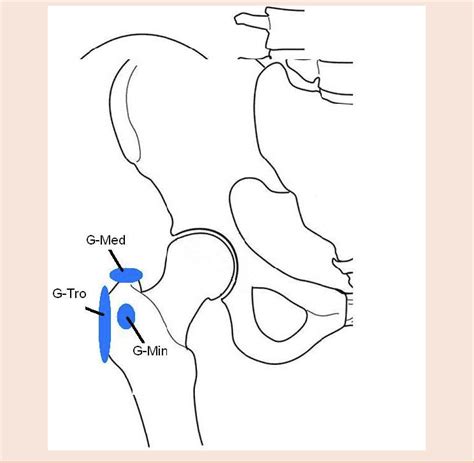 Location Of The Three Major Bursa Located On The Lateral Aspect Of The