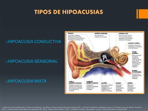 Ppt Acumetria Audiometria Logoaudiometria Impedanciometria Powerpoint Presentation Id1014758