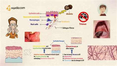 Oral Submucous Fibrosis - Animation