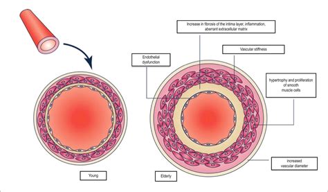 Scielo Brasil Vascular Aging And Arterial Stiffness Vascular Aging