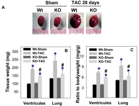 Inos Deletion Attenuates Ventricular Hypertrophy And Pulmonary