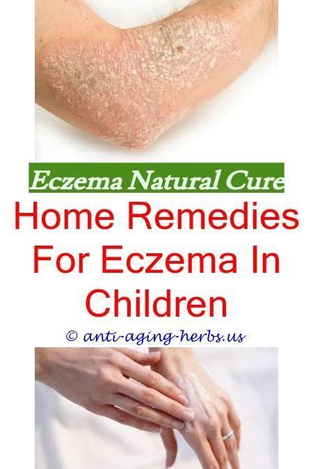 Eczema Skin Rashes Treatment Porn Sex Picture