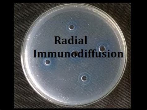 Radial Immunodiffusion Teaching Kit YouTube