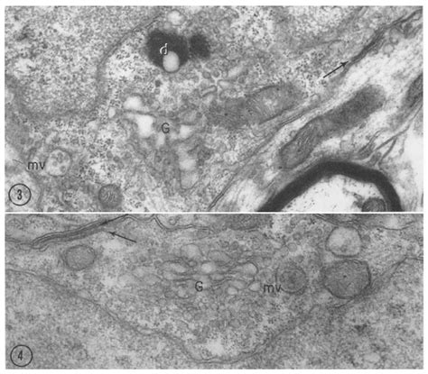 This Micrograph Of Granule Cell Cytoplasm Shows The Golgi Apparatus