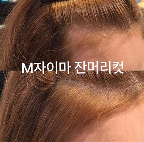 M자이마 잔머리 컨투어링💇🏻 헤어라인을 채워줌으로 문신을 하지 않고도 가능한 M자이마 컨투어링 잔머리컷 머리를 묶어 8