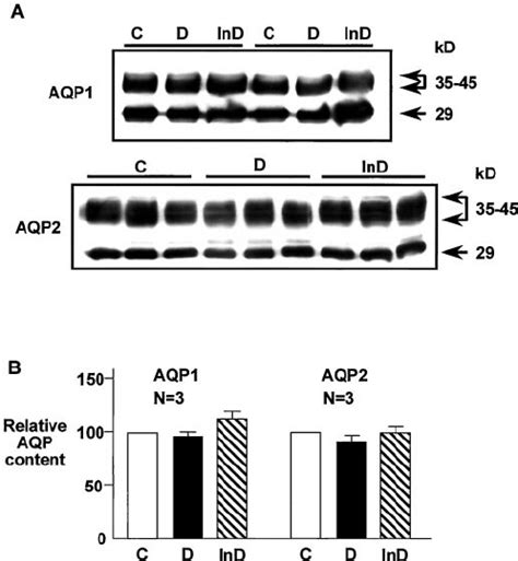 Expression Of Aquaporin 1 AQP1 And AQP2 Is Unchanged In STZ Diabetic