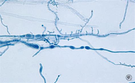 BOC Mycology and Parasitology Flashcards | Quizlet