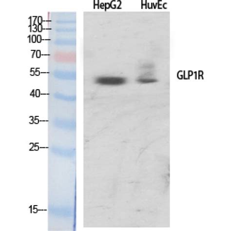 Anti-GLP1R / GLP-1 Receptor Antibody | Rabbit anti-Human | LSBio