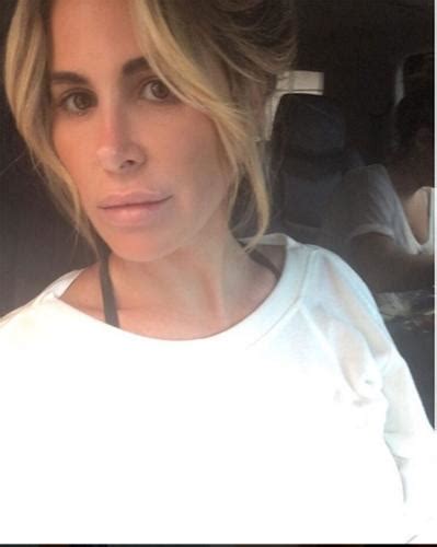 Kim Zolciak Biermann Plastic Surgery Claims Exposed By Top Docs