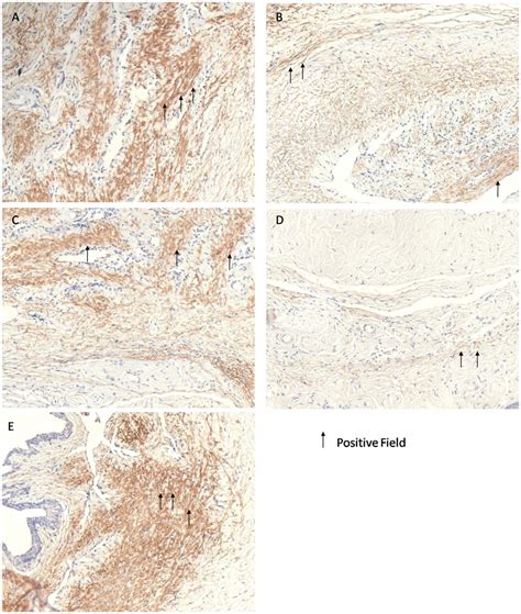 The Nnos Immunohistochemical Staining Of Rat Corpus Cavernosum In Nc