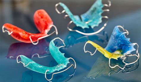 How to Deal with a Broken Retainer - Orthodontic Blog | Orthodontic ...