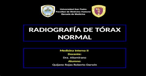 Diagnóstico Por Imágenes Radiografía De Tórax Normal Pptx Powerpoint