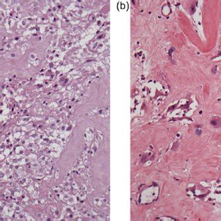 A Histological Hematoxylin And Eosin Stain 10X Magnification Of The