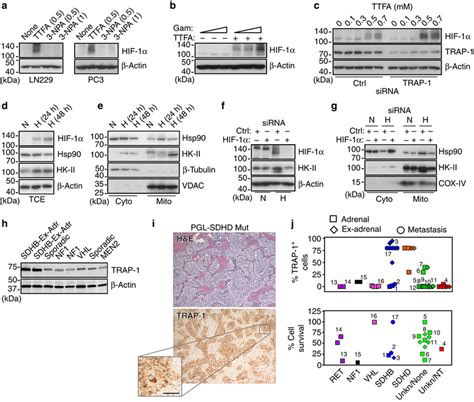 Trap 1 Sdhb Complex Regulates Hif 1α Directed Tumorigenesis A The Download Scientific