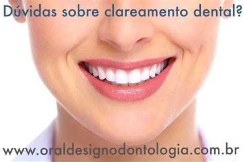 Dúvidas sobre clareamento dental Oral Design Odontologia