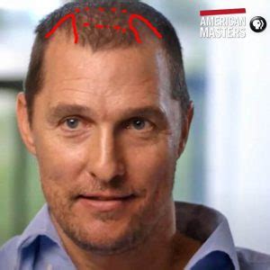 Matthew McConaughey Hair Loss Secrets Revealed!