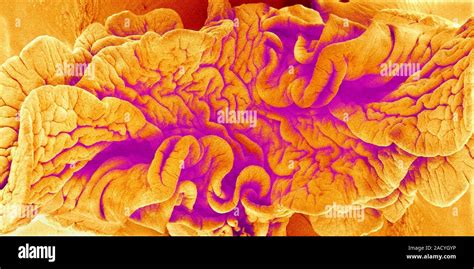 Fimbriae Of A Fallopian Tube Coloured Scanning Electron Micrograph Sem Fimbriae Are The