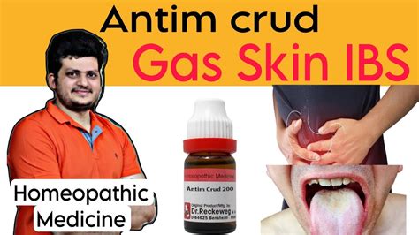 Antim Crud Homeopathic Medicine Gas Skin Headache Ibs Symptoms