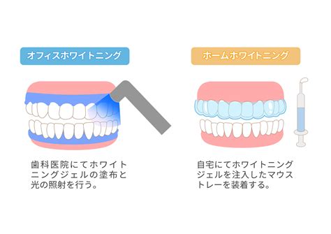 ホワイトニングの種類とメカニズム Ocean歯科クリニック