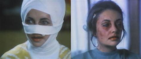 Elizabeth Taylor Nose Job