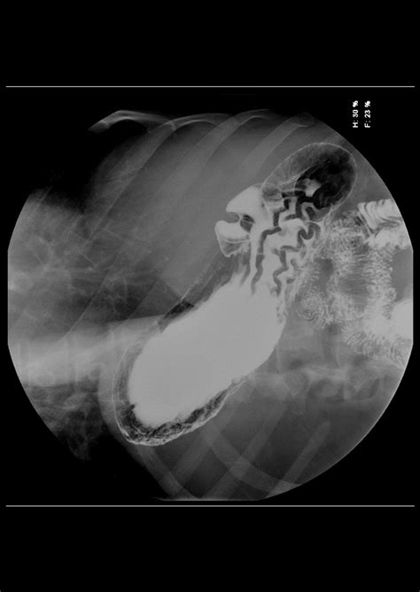 Fluoroscopy Scans & Examinations in Walvis Bay, Namibia - ERAD Radiology